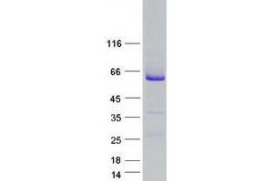 RAB3A Interacting Protein (Rabin3) (RAB3IP) protein (Myc-DYKDDDDK Tag)