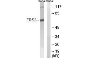 Western blot analysis of extracts from HepG2 cells, using FRS2 (Ab-196) antibody. (FRS2 antibody  (Tyr196))