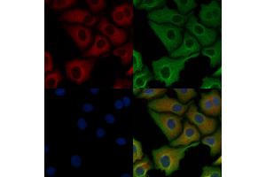 ABIN6263603 and ABIN6278495 staining Hela cells by IF/ICC.