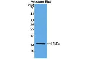 Detection of Recombinant KLb, Human using Monoclonal Antibody to Klotho Beta (KLb) (Klotho beta antibody  (AA 517-636))
