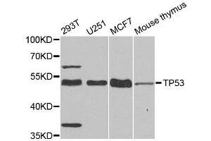 Western blot analysis of extracts of various cell lines, using TP53 antibody. (p53 antibody  (C-Term))