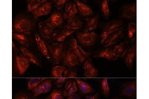 Immunofluorescence analysis of U-2 OS cells using ITSN2 Polyclonal Antibody at dilution of 1:100. (Intersectin 2 antibody)