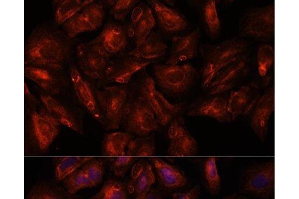 Intersectin 2 antibody