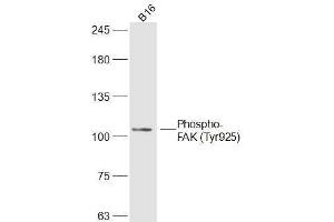 B16 lysates probed with Phospho-FAK (Tyr925) Polyclonal Antibody, Unconjugated  at 1:300 dilution and 4˚C overnight incubation. (FAK antibody  (pTyr925))