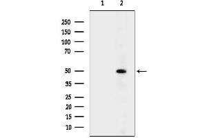 anti-RRIO Kinase 3 (RIOK3) (Internal Region) antibody