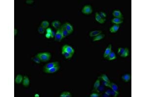Immunofluorescent analysis of HepG2 cells using ABIN7165052 at dilution of 1:100 and Alexa Fluor 488-congugated AffiniPure Goat Anti-Rabbit IgG(H+L) (ZBTB8OS antibody  (AA 2-136))