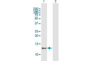 Western Blot analysis of SNRNP25 expression in transfected 293T cell line by SNRNP25 MaxPab polyclonal antibody. (SNRNP25 antibody  (AA 1-132))