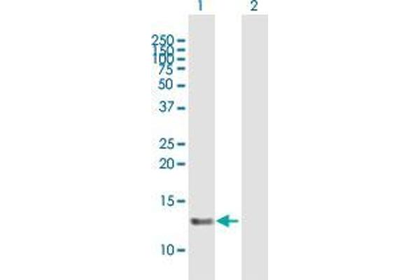SNRNP25 antibody  (AA 1-132)
