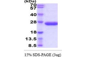 SDS-PAGE (SDS) image for Interleukin 6 (IL6) (AA 25-211) (Active) protein (His tag) (ABIN5855052) (IL-6 Protein (AA 25-211) (His tag))