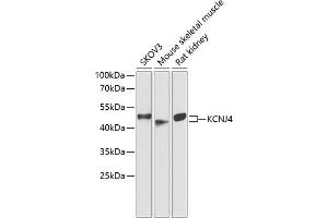 Western blot analysis of extracts of various cell lines, using KCNJ4 antibody (ABIN6134096, ABIN6142734, ABIN6142737 and ABIN6218214) at 1:1000 dilution. (KCNJ4 antibody  (AA 50-150))