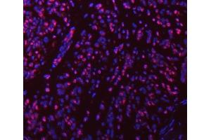 IF analysis of SART1 using anti-SART1 antibody (ABIN7599884). (SART1 antibody  (AA 125-800))