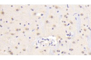 Detection of TREM2 in Rat Cerebrum Tissue using Polyclonal Antibody to Triggering Receptor Expressed On Myeloid Cells 2 (TREM2) (TREM2 antibody  (AA 1-228))