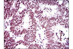 Immunohistochemistry (IHC) image for anti-Ring Finger Protein 1 (RING1) (AA 79-263) antibody (ABIN1845880) (RING1 antibody  (AA 79-263))