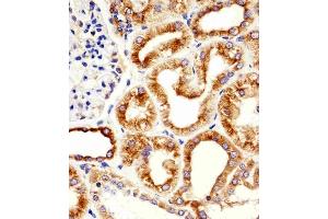 Immunohistochemical analysis of paraffin-embedded H. (TUBB antibody)