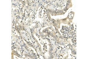 IHC analysis of BubR1/BUB1B using anti-BubR1/BUB1B antibody (ABIN7600960).