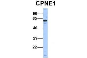 Host:  Rabbit  Target Name:  CPNE1  Sample Type:  Human Hela  Antibody Dilution:  1. (CPNE1 antibody  (Middle Region))