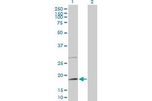 Western Blot analysis of TAF8 expression in transfected 293T cell line by TAF8 MaxPab polyclonal antibody.