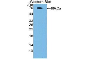 Western Blotting (WB) image for anti-Coagulation Factor II (Thrombin) Receptor-Like 3 (F2RL3) (AA 48-385) antibody (ABIN1869680) (F2RL3 antibody  (AA 48-385))