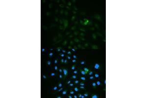 Immunofluorescence analysis of MCF7 cell using CD79B antibody. (CD79b antibody  (AA 29-159))