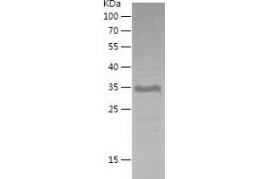 Western Blotting (WB) image for BMI1 Polycomb Ring Finger Oncogene (BMI1) (AA 100-326) protein (His tag) (ABIN7282868) (BMI1 Protein (AA 100-326) (His tag))