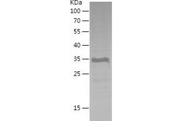 BMI1 Protein (AA 100-326) (His tag)