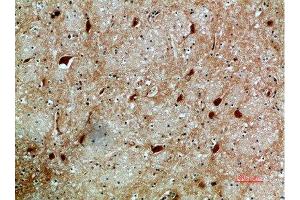 Immunohistochemical analysis of paraffin-embedded human-brain, antibody was diluted at 1:200 (NFAT5 antibody  (AA 1268-1341))