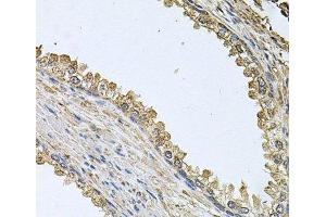 Immunohistochemistry of paraffin-embedded Human prostate using MEMO1 Polyclonal Antibody at dilution of 1:100 (40x lens). (MEMO1 antibody)