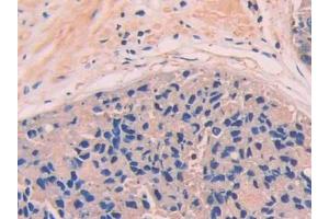 Used in DAB staining on fromalin fixed paraffin- embedded kidney tissue (Complement Factor B antibody  (AA 35-160))