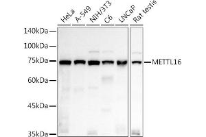 Western blot analysis of extracts of various cell lines, using METTL16 antibody (ABIN7268501) at 1:1000 dilution. (METTL16 antibody  (AA 263-562))