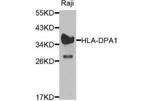 Western blot analysis of extracts of raji cells, using HLA-DPA1 antibody. (HLA-DPA1 antibody)
