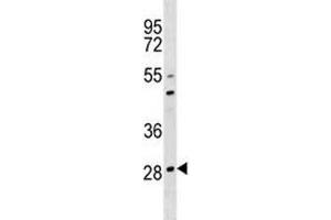 OSCAR antibody western blot analysis in 293 lysate. (OSCAR antibody  (AA 205-231))