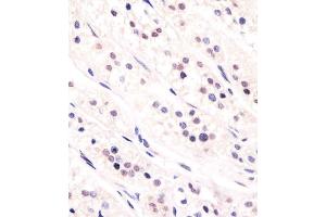 Antibody staining CDC73 in human adrenal gland tissue sections by Immunohistochemistry (IHC-P - paraformaldehyde-fixed, paraffin-embedded sections). (HRPT2 antibody  (AA 132-161))
