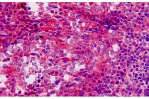 Human Tonsil: Formalin-Fixed, Paraffin-Embedded (FFPE) (SQSTM1 antibody  (AA 383-409))