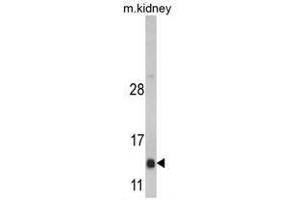 Image no. 1 for anti-DnaJ (Hsp40) Homolog, Subfamily C, Member 19 (DNAJC19) (Middle Region) antibody (ABIN452917) (DNAJC19 antibody  (Middle Region))