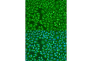 Immunofluorescence analysis of U2OS cells using LLGL2 antibody (ABIN6131794, ABIN6143262, ABIN6143265 and ABIN6224298) at dilution of 1:100. (LLGL2 antibody  (AA 620-819))