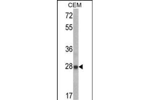 Western blot analysis of IGFBP6 Antibody (C-term) (ABIN390729 and ABIN2841001) in CEM cell line lysates (35 μg/lane).