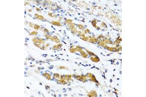 Immunohistochemistry of paraffin-embedded human stomach using OGN antibody at dilution of 1:100 (40x lens).