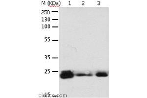 Western blot analysis of 293T cell and mouse brain tissue, A549, Hela, A172 and HT-29 cell, using RAB6A Polyclonal Antibody at dilution of 1:650 (RAB6A antibody)