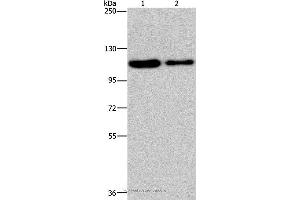 Western blot analysis of Hela and A172 cell, using PDE4A Polyclonal Antibody at dilution of 1:300 (PDE4A antibody)