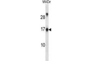 Western blot analysis in WiDr cell line lysates (35ug/lane) using NDP kinase A Antibody . (NME1 antibody  (Middle Region))