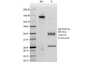 SDS-PAGE Analysis Purified CD34 Monoclonal Antibody (ICO-115). (CD34 antibody)