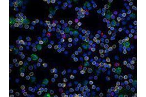 Immunofluorescence (IF) image for anti-CD19 Molecule (CD19) antibody (Alexa Fluor 594) (ABIN2656820) (CD19 antibody  (Alexa Fluor 594))