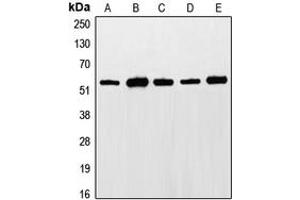 Western blot analysis of ETS1 (pT38) expression in LO2 (A), Jurkat (B), HepG2 (C), NIH3T3 (D), rat liver (E) whole cell lysates. (ETS1 antibody  (N-Term, pSer38))