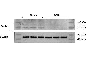 The expression of Col-IV after SAH. (COL4a3 antibody  (AA 1571-1670))