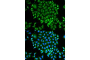 Immunofluorescence analysis of MCF-7 cells using GLRX antibody.