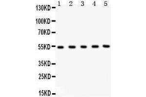 Anti- MMP3 Picoband antibody, Western blotting All lanes: Anti MMP3  at 0.