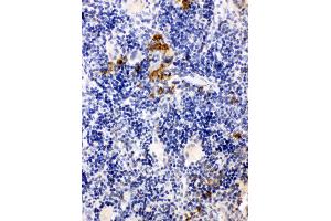 Anti-Leupaxin antibody, IHC(P) IHC(P): Rat Spleen Tissue (Leupaxin antibody  (N-Term))