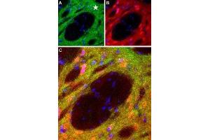Expression of DRD1 in rat striatumImmunohistochemical staining of perfusion-fixed frozen brain sections with Anti-D1 Dopamine Receptor Antibody (ABIN7043105, ABIN7044227 and ABIN7044228), (1:100), (green).