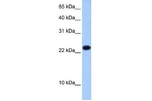 WB Suggested Anti-EIF4E3 Antibody Titration:  0. (EIF4E3 antibody  (Middle Region))