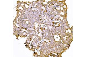 IHC analysis of Prothrombin using anti-Prothrombin antibody (ABIN7602705). (Prothrombin Fragment 2 (AA 97-124) antibody)